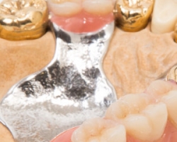 Sell Dental Gold